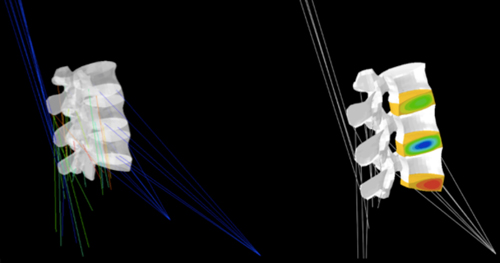 Prediction of mutual interactions between strain-induced muscle activation (Left) and intervertebral disc pressurization (right) during night rest simulations in a finite element model of the lower lumbar spine (L3 to L5-S1 intervertebral disc)