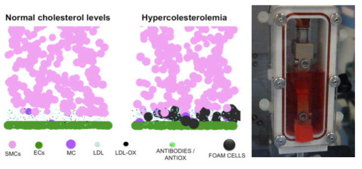 Left: Agent-based simulations for the exploration of atheroscleroma formation as a result of complex molecular and cellular interactions. Right: Dynamic culture of a cell-seeded biomaterial 
