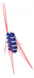 Patient-specific finite element model of the musculoskeletal lumbar spine, including the lumbo-sacral joint 