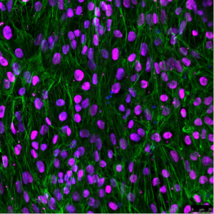 Imagen: Células similares a cardiomiocitos derivadas de células madre pluripotentes humanas