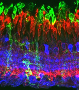 Imagen histológica de la retina de un animal rd10 al mes de edad, en la que se observa una alteración importante de la capa de los fotorreceptores de la retina.