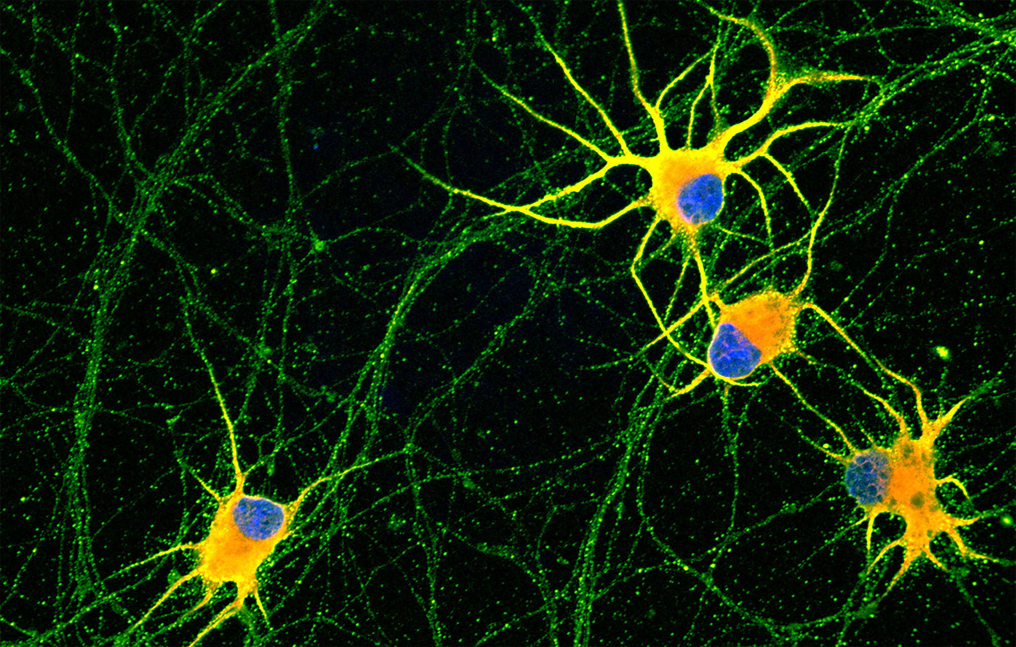 Fluorescent images of human neurons
