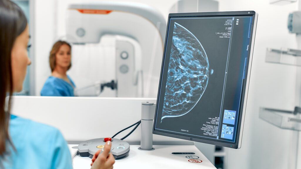 In the hospital, the patient undergoes a screening procedure for a mammogram.