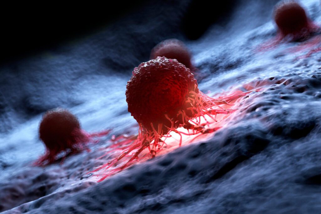 Illustration of a human cancer cell