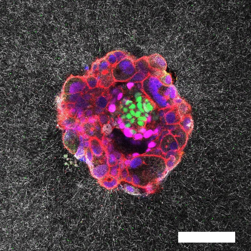 Embrió humà de 9 dies vist al microscopi confocal: cèl·lules de contorn vermell i nuclis liles, verds i magenta sobre un gel de fibres grises.