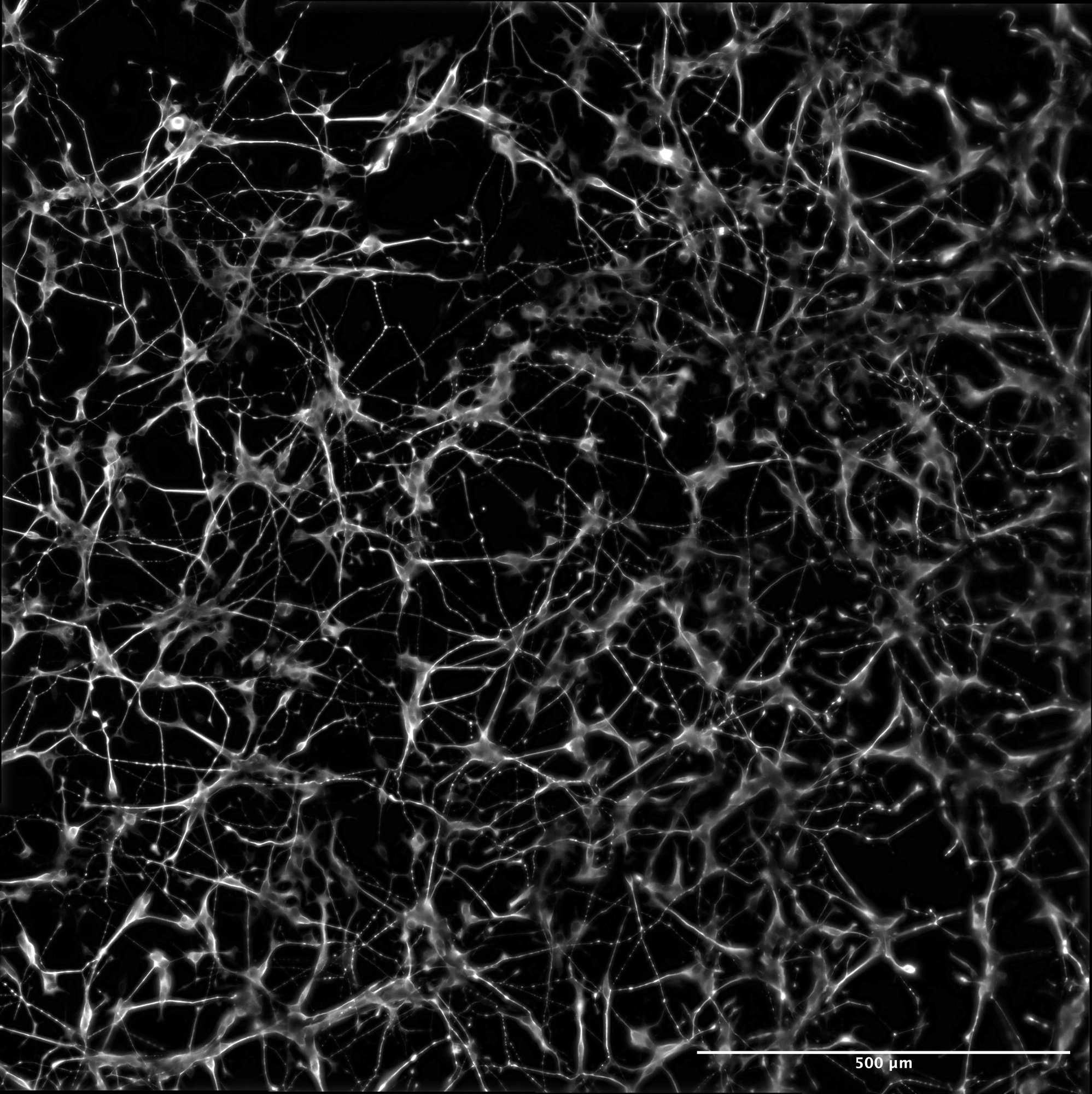 Xarxa densa de cèl·lules semblants a neurones, en blanc sobre fons negre, unides per prolongacions molt fines.