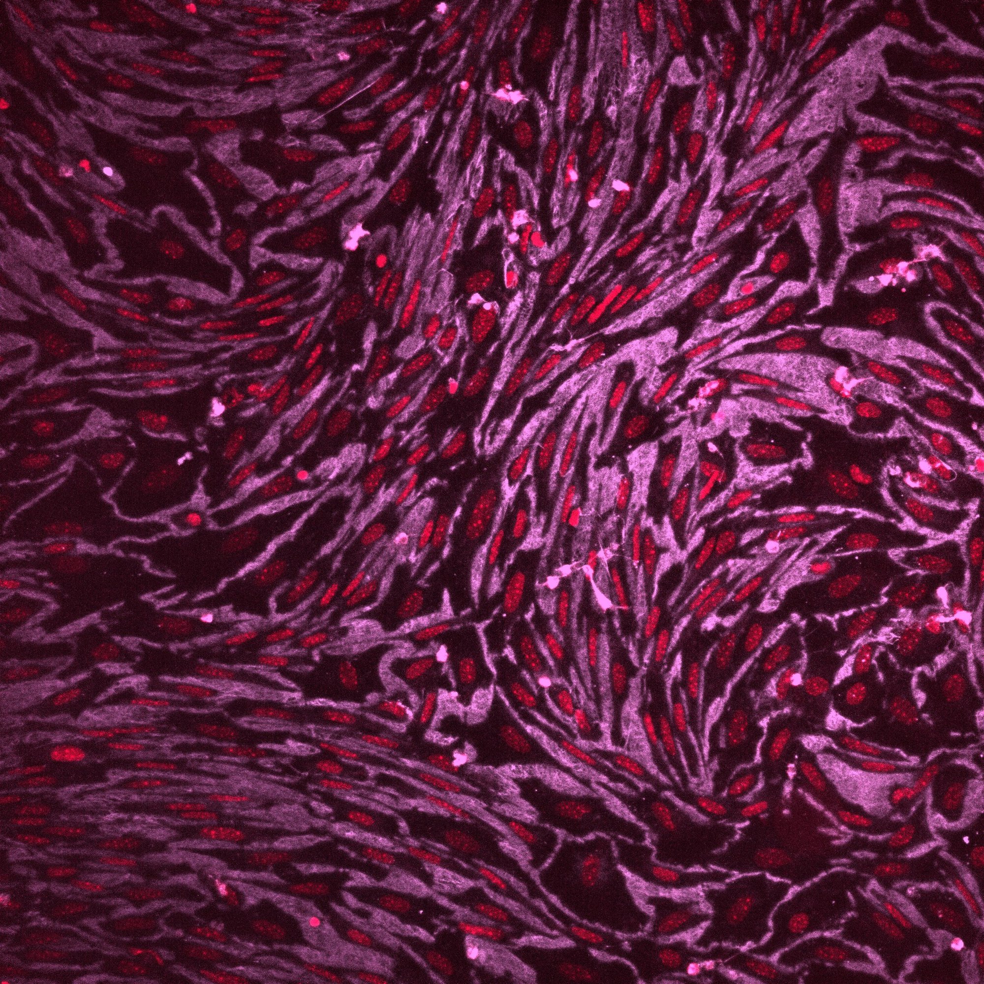 Nuclis vermells allargats envoltats d’una trama fibrosa rosada que dibuixa corbes, com un teixit tèxtil.