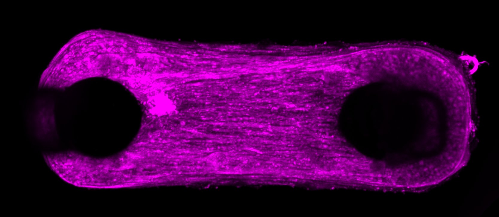 Teixit muscular de color magenta en forma de banda, amb fibres alineades entre dos forats circulars on hi ha els pilars.