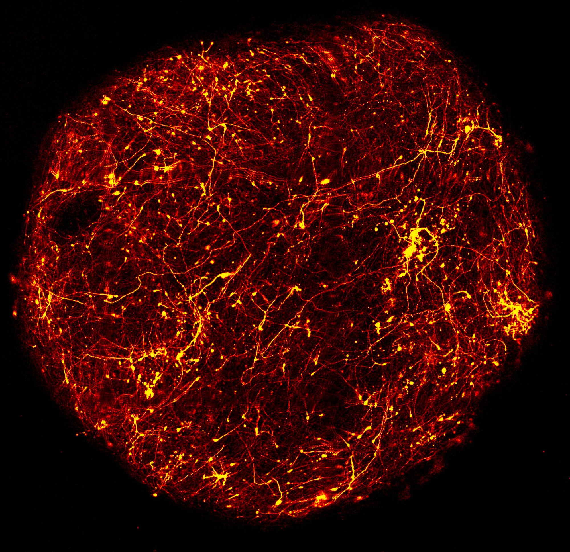 Organoide cerebral esfèric amb una xarxa de neurones en vermell i groc, com flames, sobre fons negre.