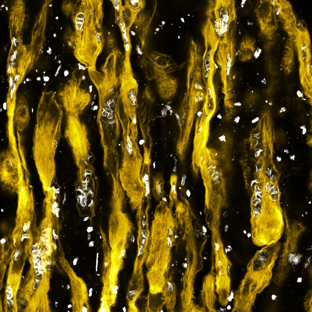 Fibres musculars grogues, allargades i verticals, amb nuclis blancs sobre fons negre.